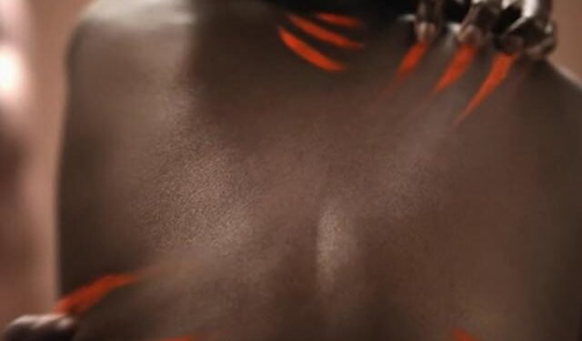 Major Brand Has Advert Banned for Suggesting Black Skin Is ‘Problematic’