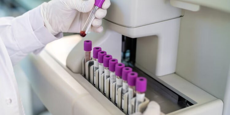 Scientists Announce First Potentially Accurate Blood Test for Chronic Fatigue Syndrome