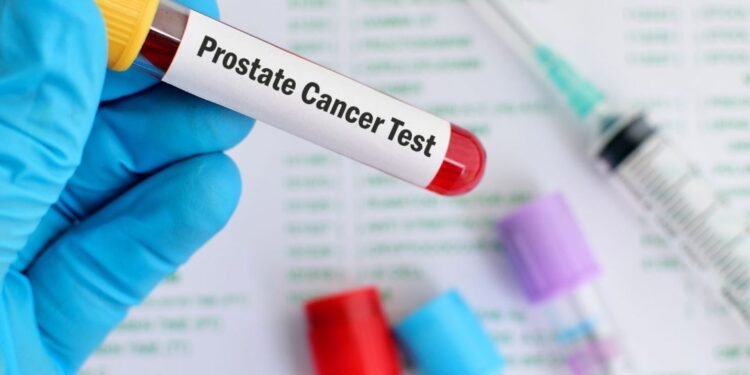 New Prostate Cancer Drug Set to Halve Death Risk in England