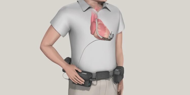 UK Centres Used Risky Heart Pump Despite Safety Fears