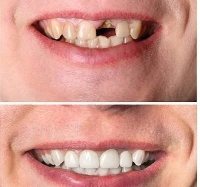 From Baby Teeth to Bioengineering: The Future of Self-Healing Teeth