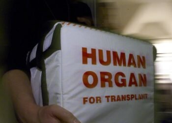 New AI tool could cut wasted efforts in organ transplants