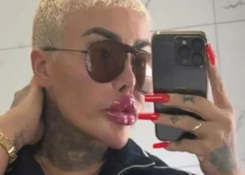 British Lip King death arrested