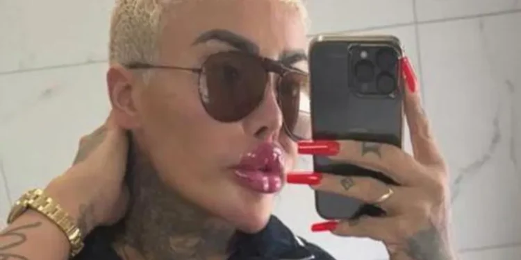 British Lip King death arrested