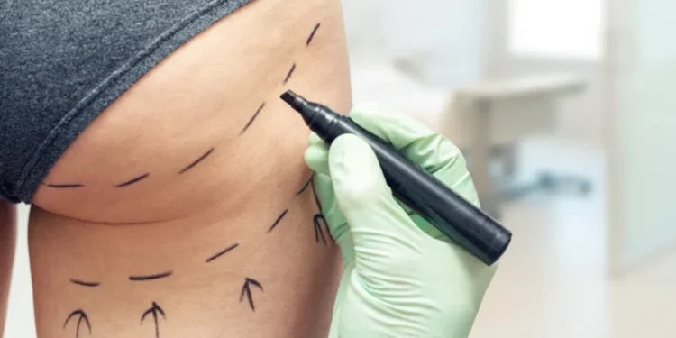 MPs Brazilian butt lift crackdown UK