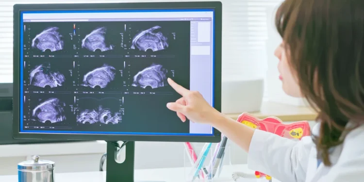 New Scan Offers Hope for Faster Endometriosis Diagnosis