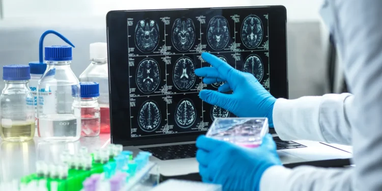 UK Alzheimer's Crisis: Trial Delays Hinder Progress