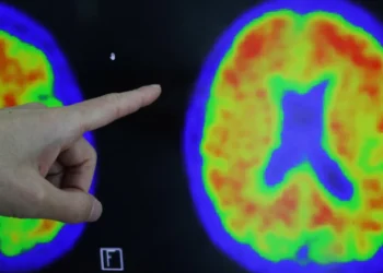 Alzheimer's at-home blood test 2026 early risk