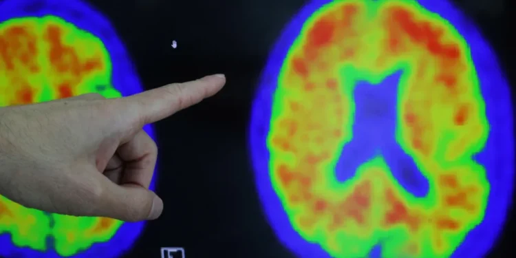 Alzheimer's at-home blood test 2026 early risk