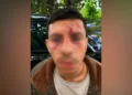 Jewish man kicked like animal Golders Green attack 2026
