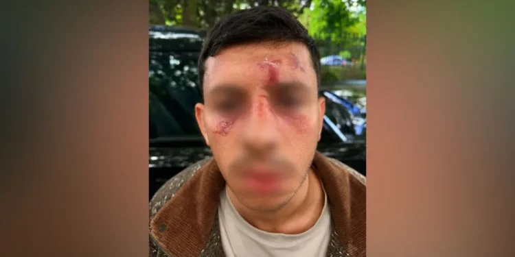 Jewish man kicked like animal Golders Green attack 2026