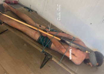 Evidence of Abuse: New Photo Sparks Global Outrage