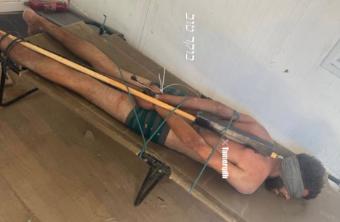 Evidence of Abuse: New Photo Sparks Global Outrage