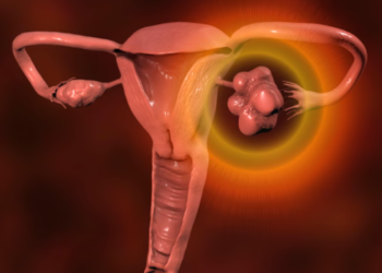 NHS Urges Investigation For Irregular Periods