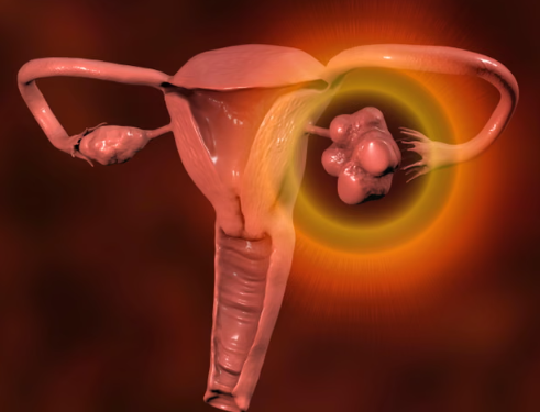 NHS Urges Investigation For Irregular Periods